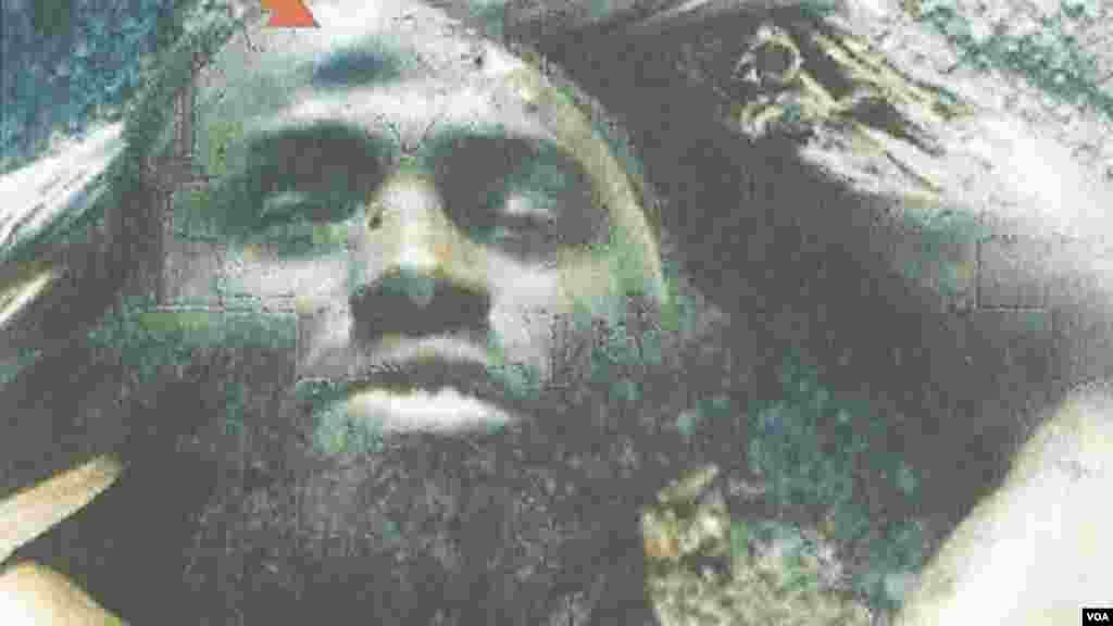 Detail of photo of the dead Mohammed Bashir showing a unique facial mark indicating the identity of the body as the same person appearing in several Boko Haram videos.