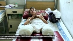 11 Members of Same Family Killed, Wounded in Afghan Blast