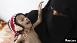 A woman holds her malnourished child at a feeding center at al-Sabyeen hospital in Yemen's capital, Sanaa, June 20, 2012.