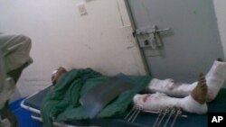 An injured man lies on a stretcher in a hospital after a suicide bombing near the southern Yemeni city of Zinjibar, capital of the Abyan province, March 4, 2012.