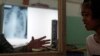Penanggulangan Tuberkulosis di Indonesia Terganggu Pandemi 