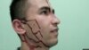 Abdullo Ghurbati posted pictures on social media after suffering what he said was an attack by two unknown assailants in Dushanbe. (Source: RFE/RL)