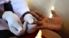 Malawi Akan Lakukan Tes HIV dari Rumah ke Rumah