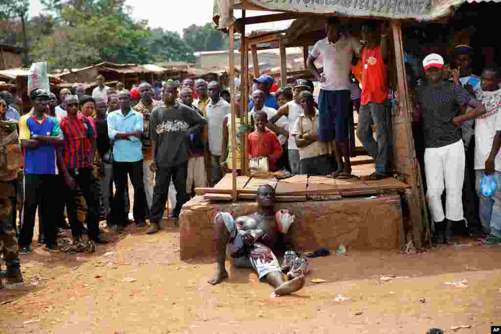 A suspected member of a Christian militia lays wounded by machete blows in the Kokoro neighborhood of Bangui, Central African Republic, Dec. 9, 2013.