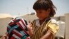 Just over a year old, Morhaf's brother, Rafaat, is malnourished because he can't eat or drink without getting sick, at the Za'atari camp in Jordan, June 17, 2015. (Photo: H. Murdock / VOA)