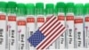WHO: Limited surveillance hampers bird flu risk assessment 