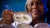 FILE - This undated photo shows a CDC technician making notations on culture plates in which fungal colonies had been grown. The fungus Candida auris has spread to more than 30 countries in the past decade. 