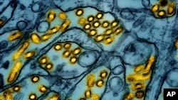 Arhiv: Obojena mikroskopska slika čestica Ptičje gripe, koju je objavio Nacionalni institut za alergije i infektivne bolesti, 26. marta 2024. (Foto: AP/CDC/NIAID)