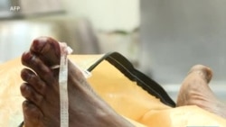 Les morgues sud-africaines croulent sous les corps non-identifiés
