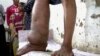 Treated Bed Nets Critical to Eradicating Debilitating Tropical Disease
