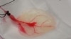 Human Heart Cells Grown on Spinach Leaves
