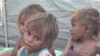 UN: 14 Million Yemenis in Danger as Famine Looms