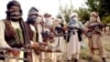 Za a yiwa wata mata matashiya ‘yar kasar Afghanistan aikin tiyatar yi ma ta sabon hanci a nan Amurka