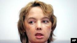 FILE - Isabelle Dinoire, the woman who received the world's first partial face transplant with a new nose, chin and mouth, in an operation on Nov. 27, 2005.