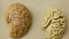 Researchers: Viruses May Help Cause Alzheimer’s Disease