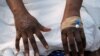 En RDC, des malades atteints du Mpox ont fui l'hôpital de Goma, selon l'OMS