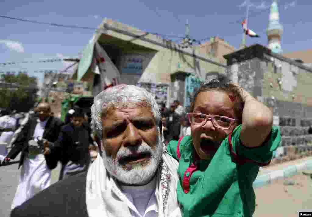 An injured girl reacts as she is carried by a man out of a mosque which was attacked by a suicide bomber in Sanaa, Yemen. At least 16 people were killed when bombers blew themselves up in two mosques during noon prayers. The mosques are known to be used mainly by supporters of the Shi'ite Muslim Houthi group which has seized control of the government.