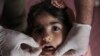 In Iraq, Mass Polio Vaccination Campaign Underway 
